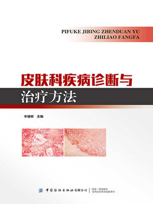 cover image of 皮肤科疾病诊断与治疗方法